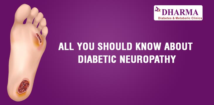 ALL YOU SHOULD KNOW ABOUT DIABETIC NEUROPATHY