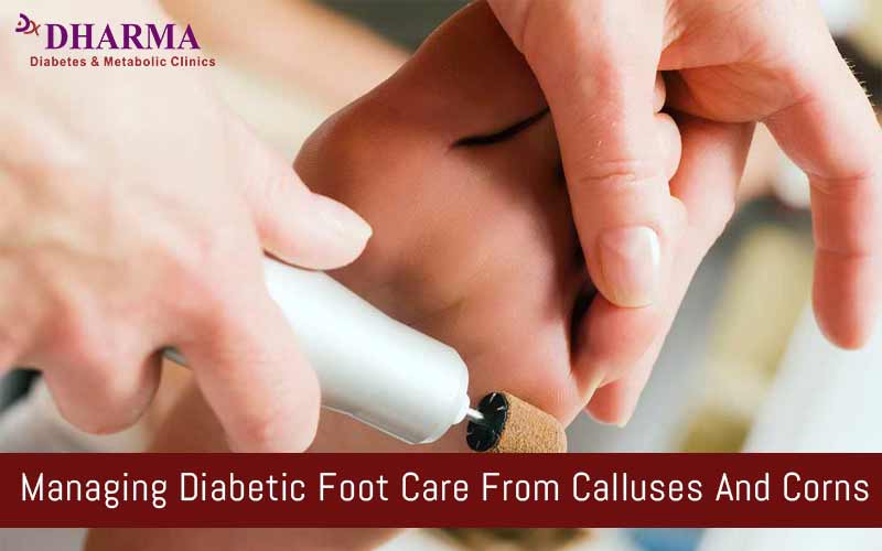 MANAGING DIABETIC FOOT CARE FROM CALLUSES AND CORNS