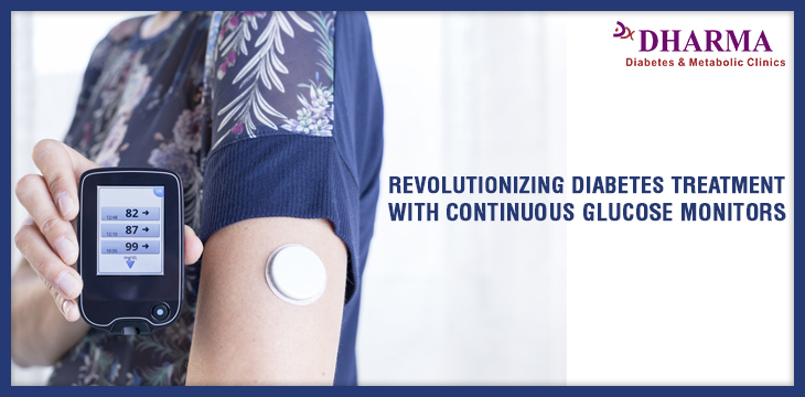REVOLUTIONIZING DIABETES TREATMENT WITH CONTINUOUS GLUCOSE MONITORS