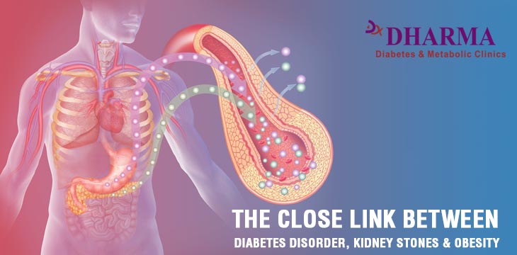THE CLOSE LINK BETWEEN DIABETES DISORDER, KIDNEY STONES & OBESITY